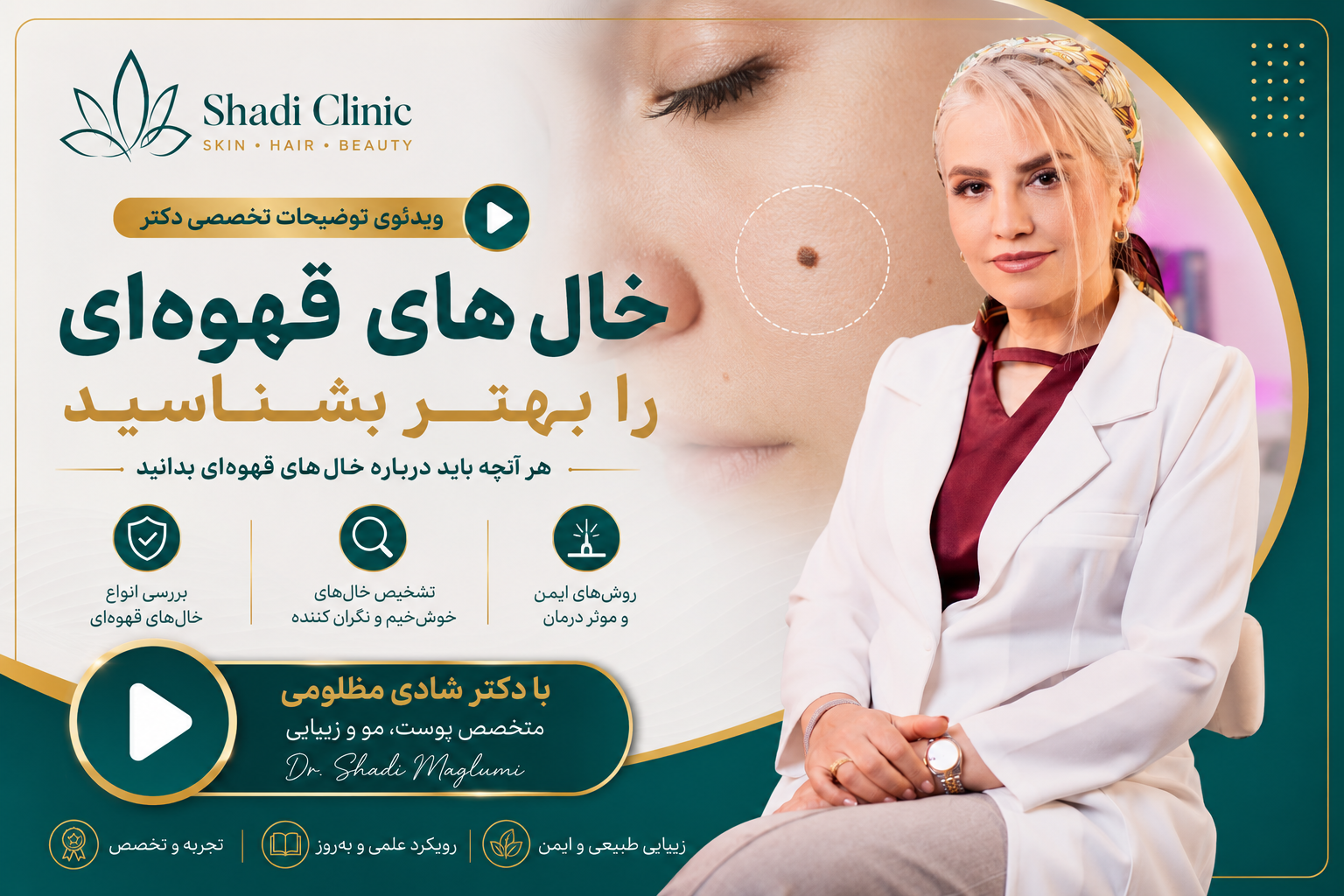 خال‌های قهوه‌ای پوست؛ کدام بی‌خطرند و چه زمانی باید جدی گرفت؟